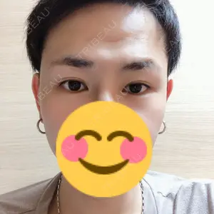 32 days after image
