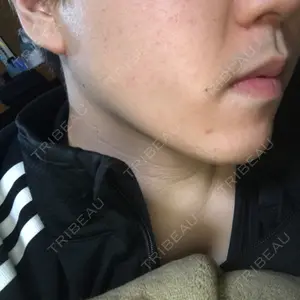 27 days after image