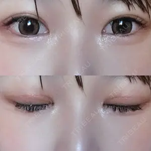 90 days after image