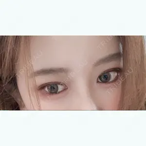 120 days after image