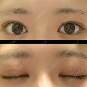 13 days after image