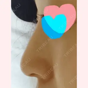 15 days after image