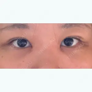 30 days after image