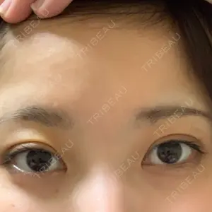 6 days after image