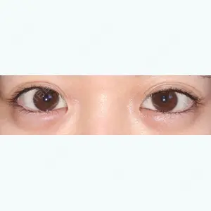 178 days after image