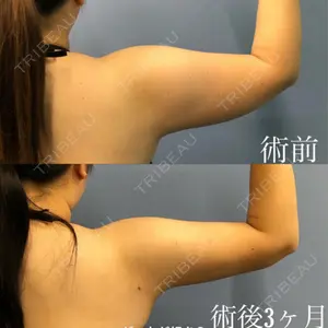 93 days after image