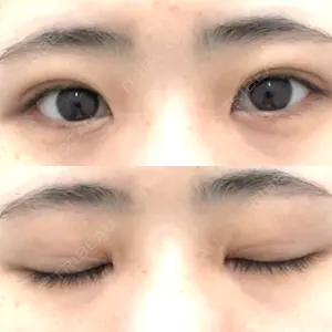 39 days after image