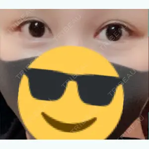 30 days after image