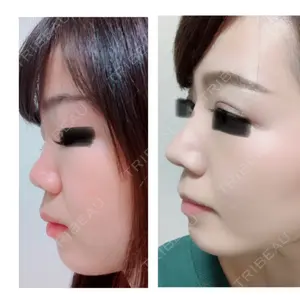 330 days after image