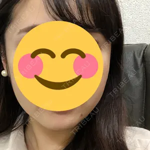 92 days after image