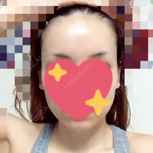 21 days after image
