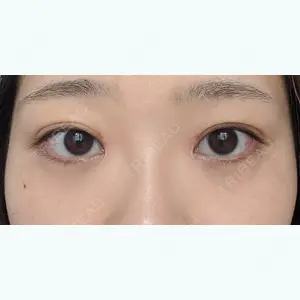 64 days after image