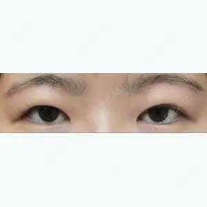 81 days after image