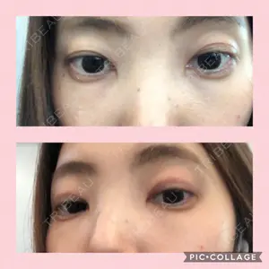 14 days after image