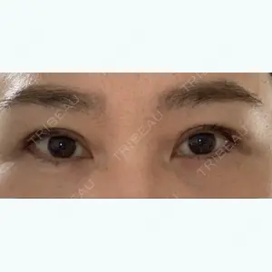 89 days after image