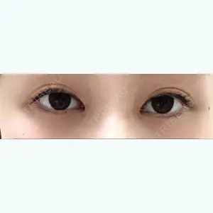 27 days after image