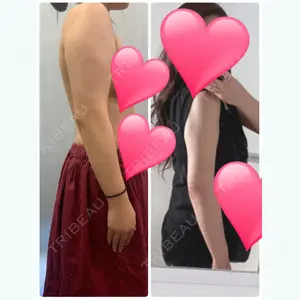 171 days after image