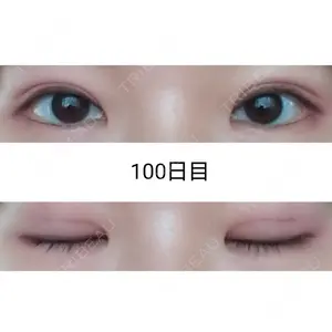 100 days after image