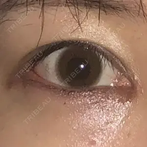 22 days after image