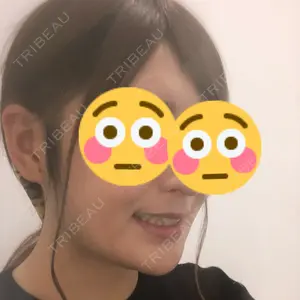 98 days after image