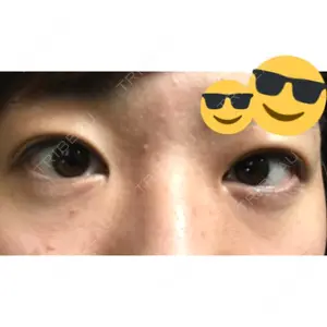 181 days after image