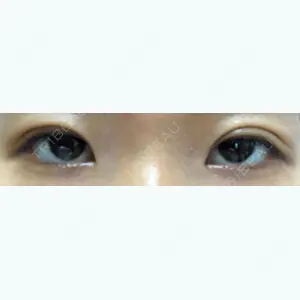 146 days after image