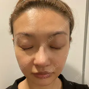91 days after image