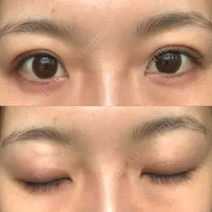 85 days after image