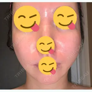 110 days after image
