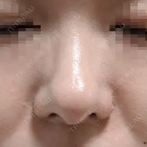 28 days after image