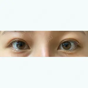56 days after image