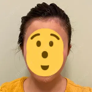 102 days after image