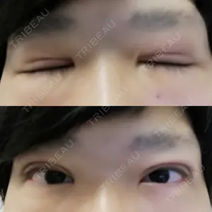 63 days after image