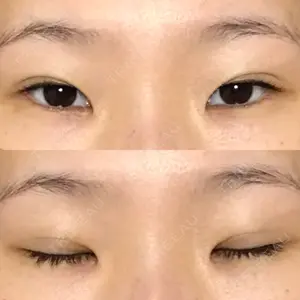 42 days after image