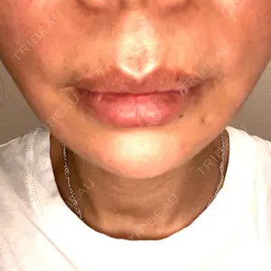 9 days after image