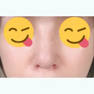12 days after image