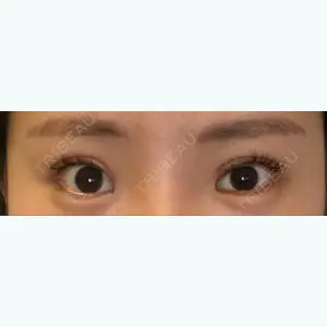 58 days after image