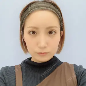 101 days after image