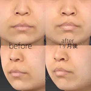 48 days after image