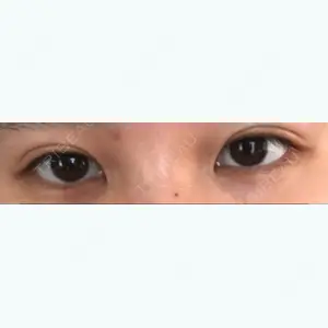 123 days after image