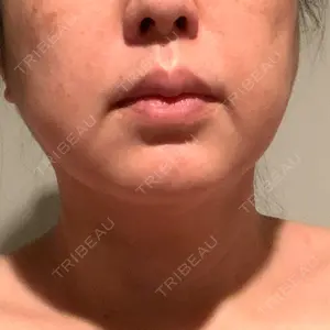 60 days after image