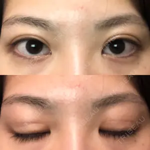 191 days after image