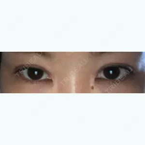 126 days after image