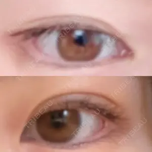 101 days after image