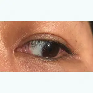 68 days after image