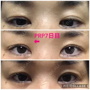 口コミ