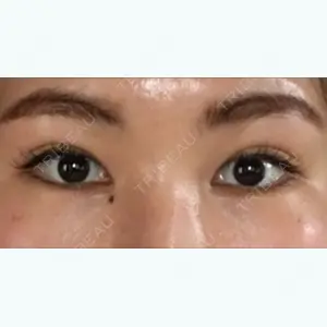 164 days after image