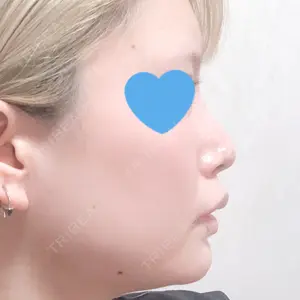 78 days after image