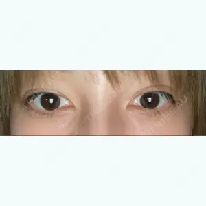 92 days after image