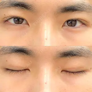30 days after image